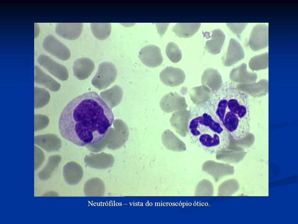 Neutrófilos – vista do microscópio ótico.