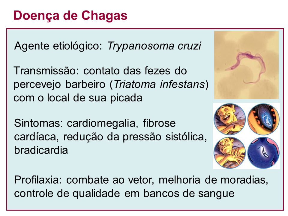 Doença de Chagas Agente etiológico: Trypanosoma cruzi