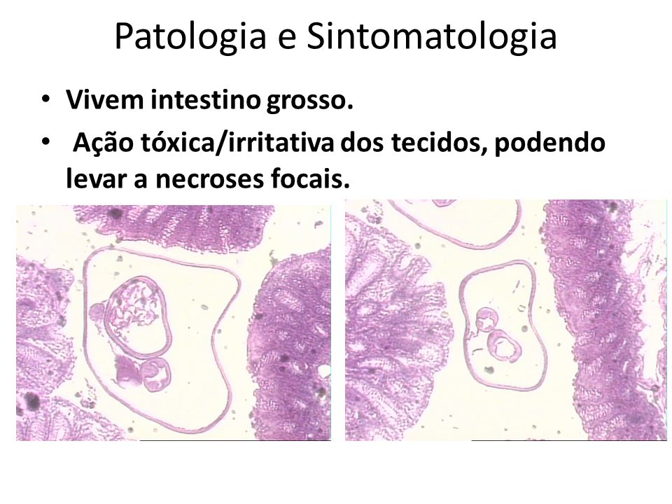 Patologia e Sintomatologia