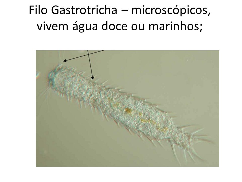 Filo Gastrotricha – microscópicos, vivem água doce ou marinhos;