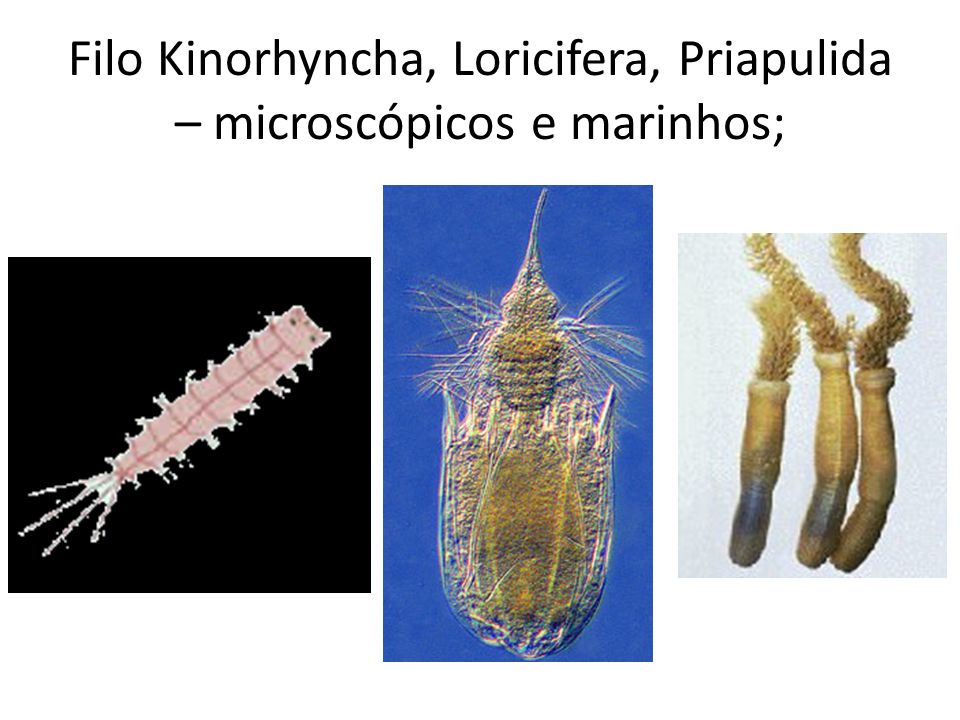 Filo Kinorhyncha, Loricifera, Priapulida – microscópicos e marinhos;