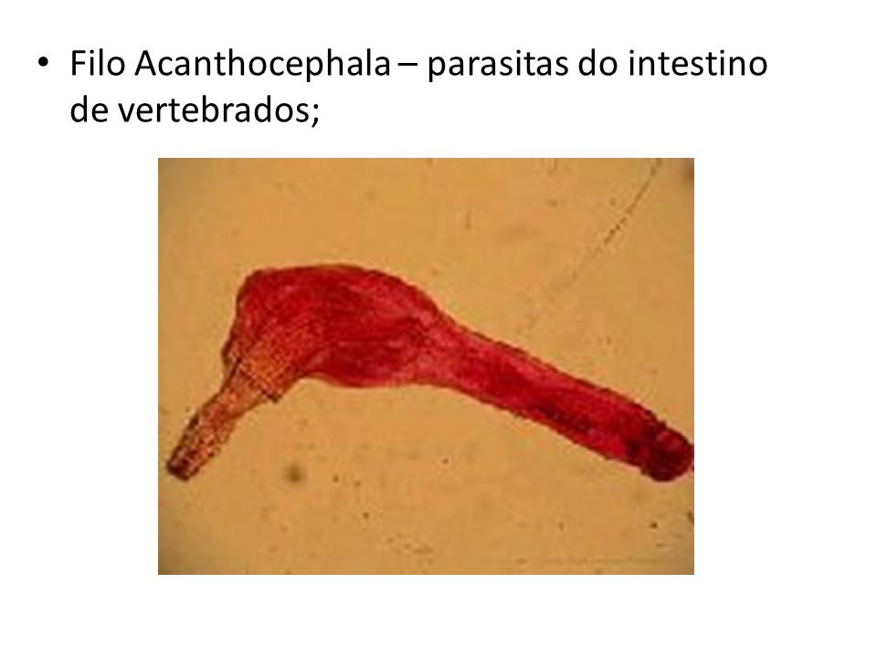 Filo Acanthocephala – parasitas do intestino de vertebrados;
