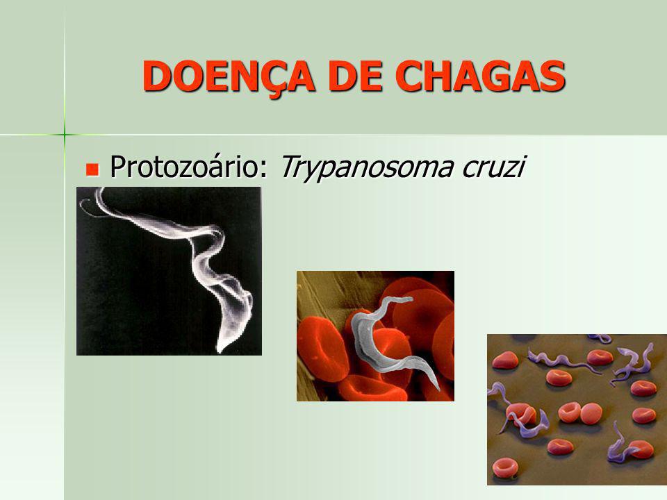 DOENÇA DE CHAGAS Protozoário: Trypanosoma cruzi