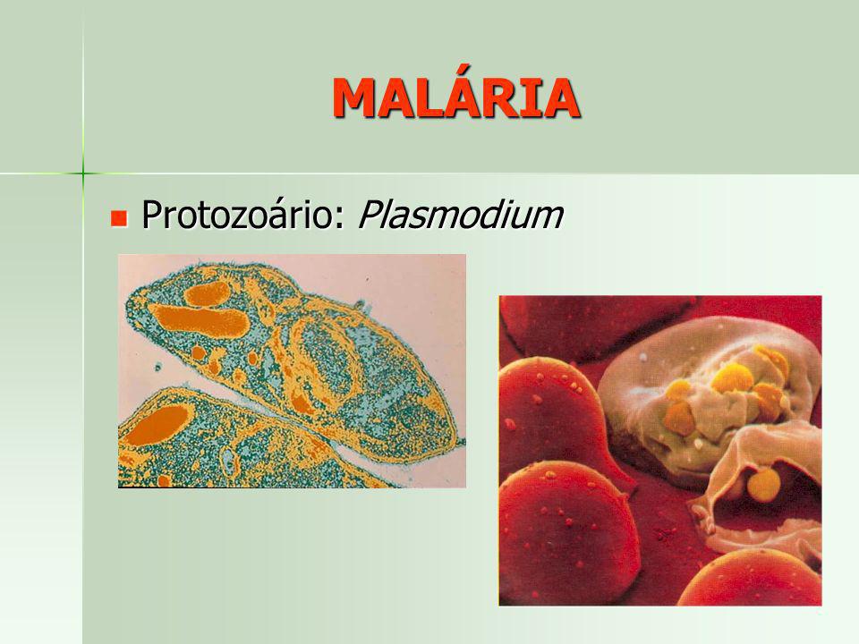 MALÁRIA Protozoário: Plasmodium