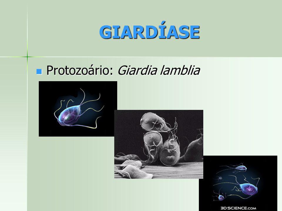 GIARDÍASE Protozoário: Giardia lamblia