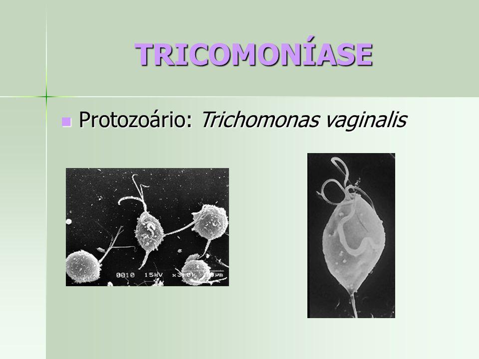 TRICOMONÍASE Protozoário: Trichomonas vaginalis