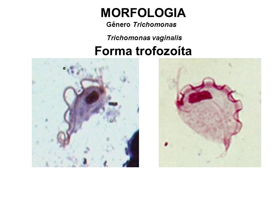 toxoplazma és trichomonas