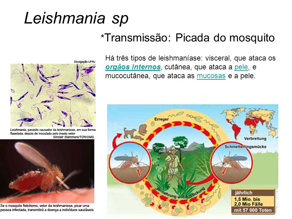 Leishmania sp *Transmissão: Picada do mosquito