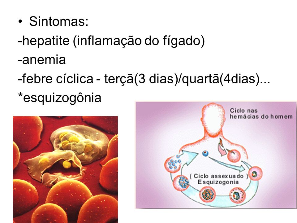 Sintomas: -hepatite (inflamação do fígado) -anemia. -febre cíclica - terçã(3 dias)/quartã(4dias)...