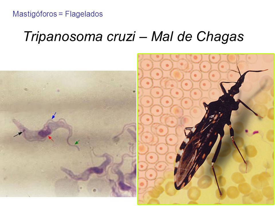 Tripanosoma cruzi – Mal de Chagas