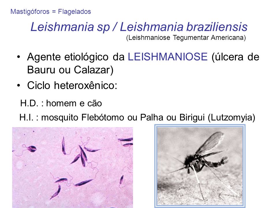 Leishmania sp / Leishmania braziliensis