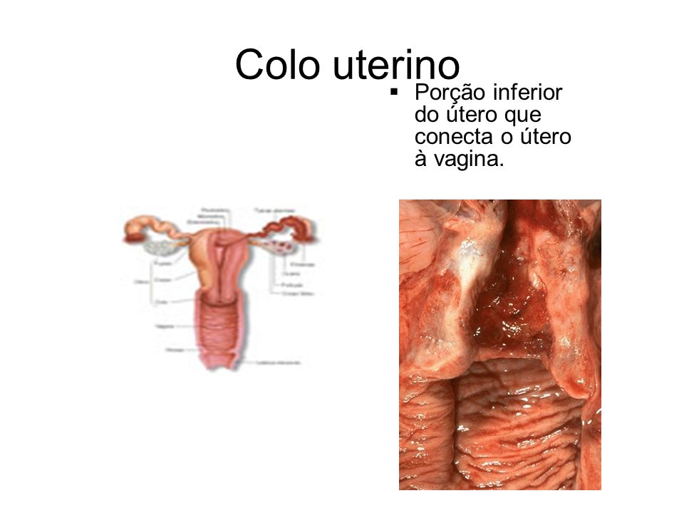 Colo uterino Porção inferior do útero que conecta o útero à vagina.