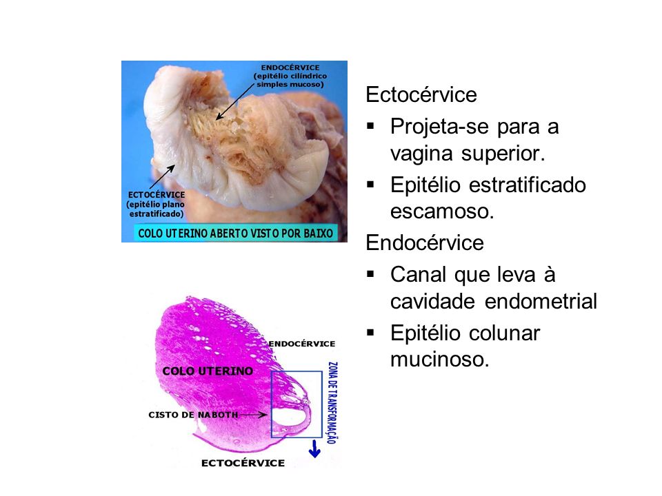 Ectocérvice Projeta-se para a vagina superior. Epitélio estratificado escamoso. Endocérvice. Canal que leva à cavidade endometrial.
