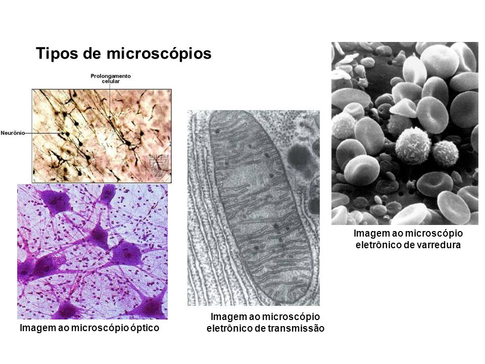 Tipos de microscópios Imagem ao microscópio eletrônico de varredura