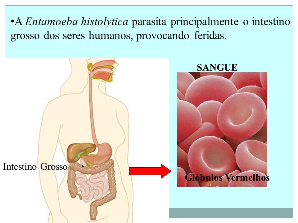 A Entamoeba histolytica parasita principalmente o intestino grosso dos seres humanos, provocando feridas.