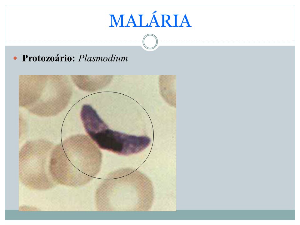 MALÁRIA Protozoário: Plasmodium