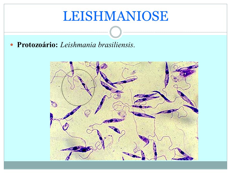 LEISHMANIOSE Protozoário: Leishmania brasiliensis.