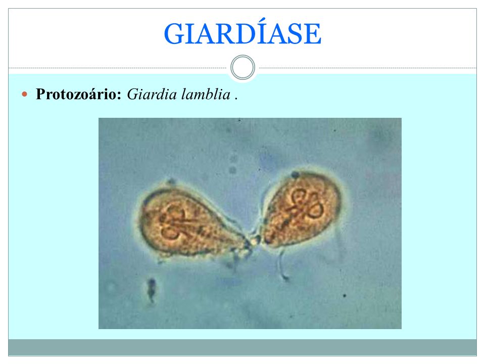 GIARDÍASE Protozoário: Giardia lamblia .
