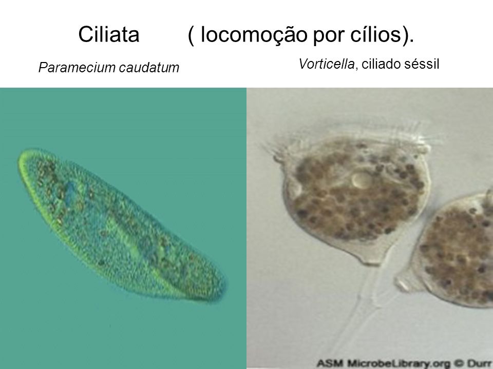 Ciliata ( locomoção por cílios).