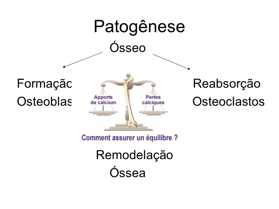 Patogênese Ósseo Formação Reabsorção Osteoblastos Osteoclastos