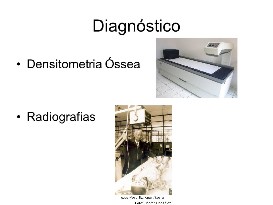 Diagnóstico Densitometria Óssea Radiografias