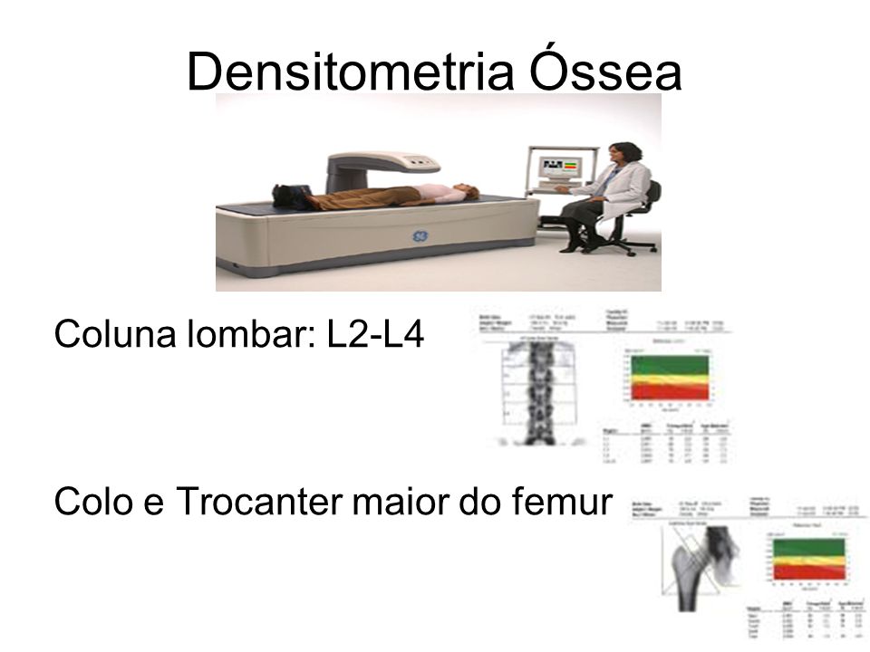 Densitometria Óssea Coluna lombar: L2-L4