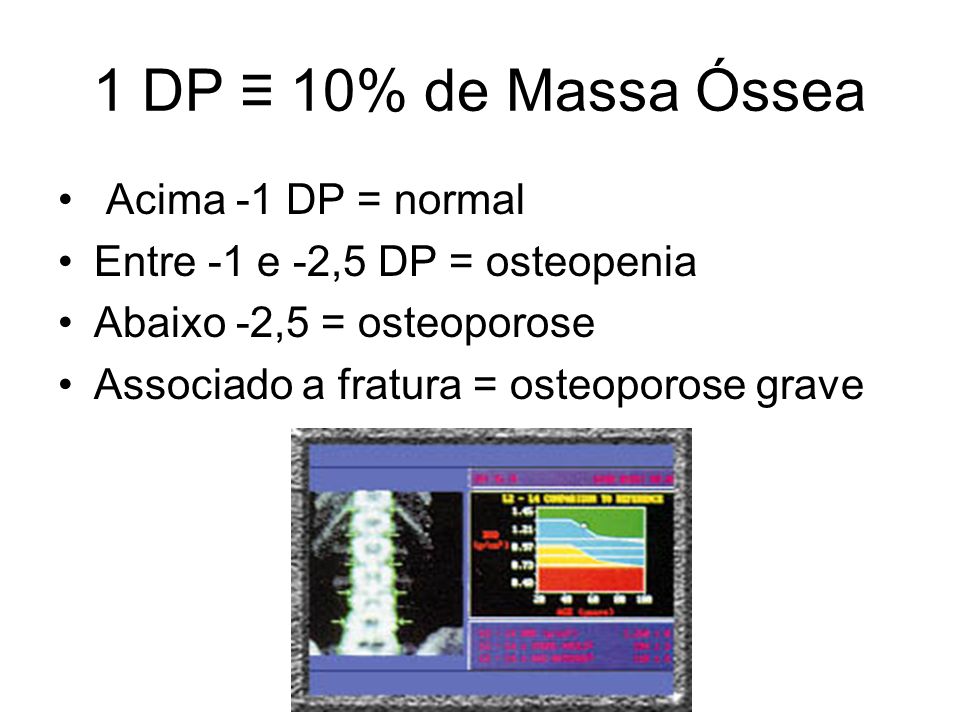 1 DP ≡ 10% de Massa Óssea Acima -1 DP = normal
