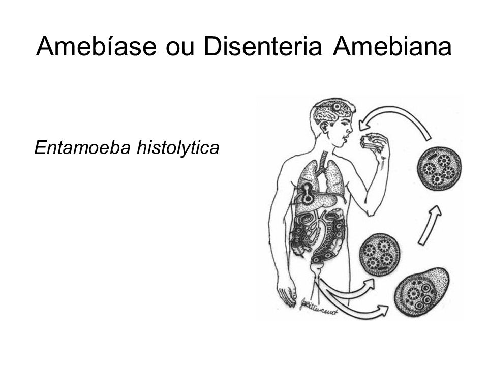 Amebíase ou Disenteria Amebiana