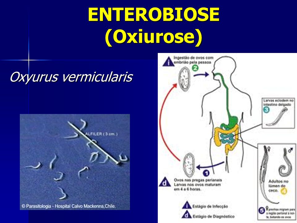ENTEROBIOSE (Oxiurose)