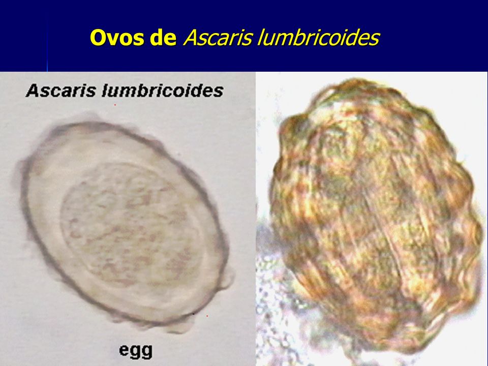 Ovos de Ascaris lumbricoides