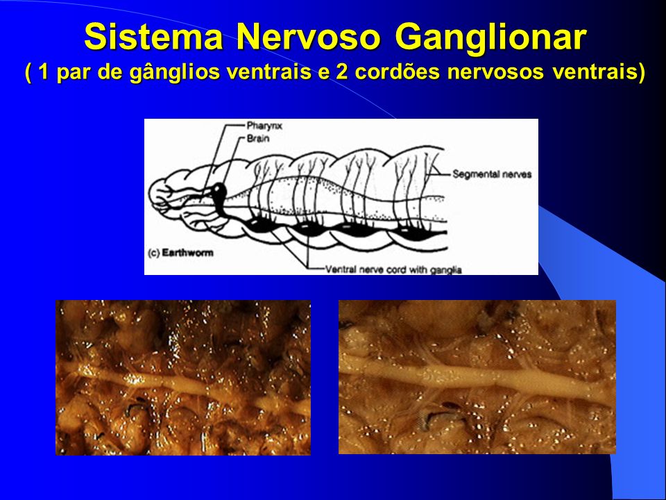 Sistema Nervoso Ganglionar