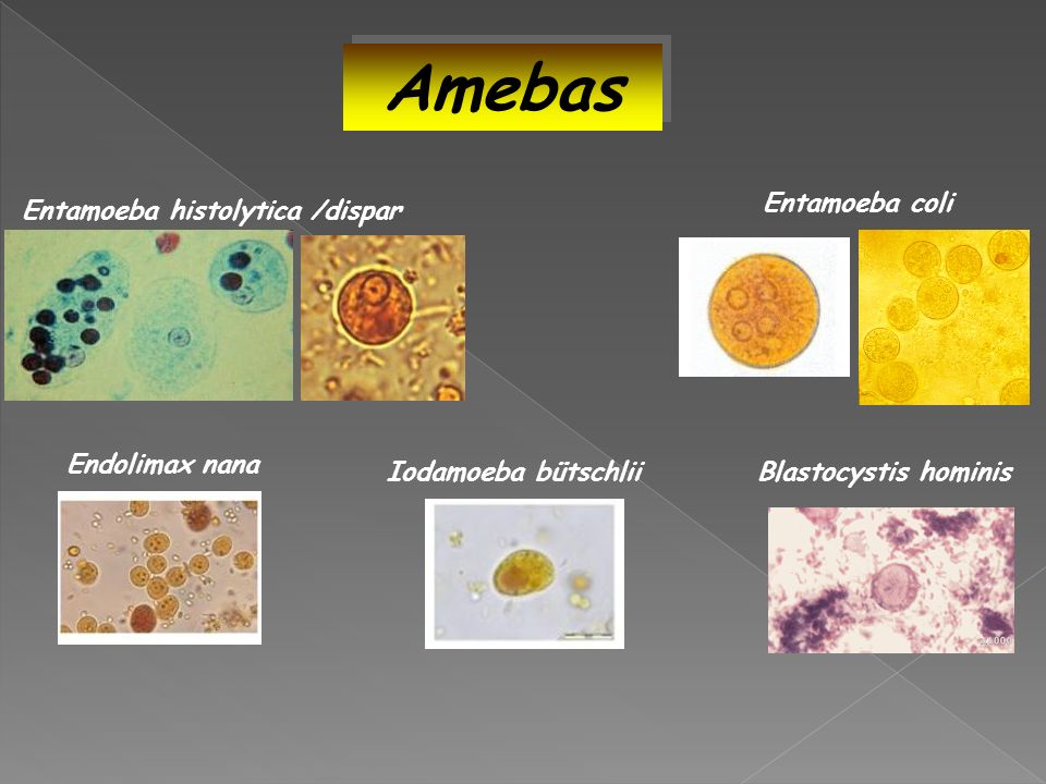 Entamoeba coli в кале. Entamoeba histolytica. Entamoeba histolytica под микроскопом. Цисты Endolimax Nana. Энтамеба хистолитика.