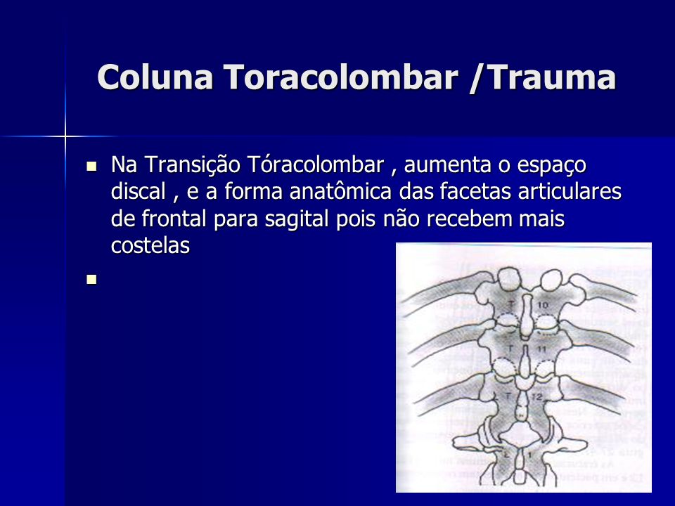Coluna Toracolombar /Trauma
