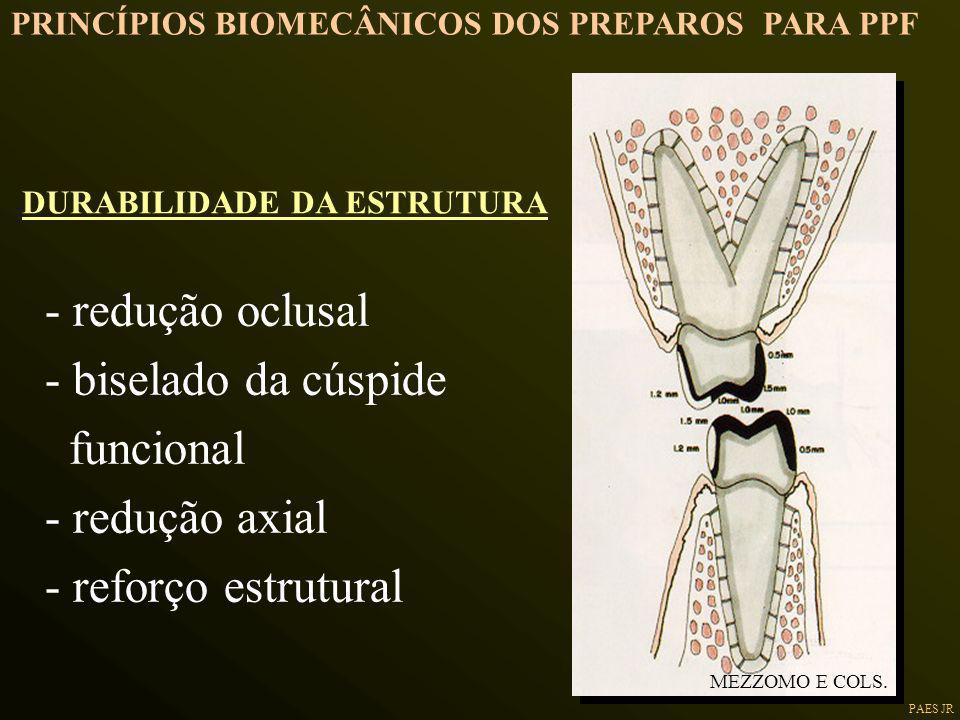 - redução oclusal - biselado da cúspide funcional - redução axial
