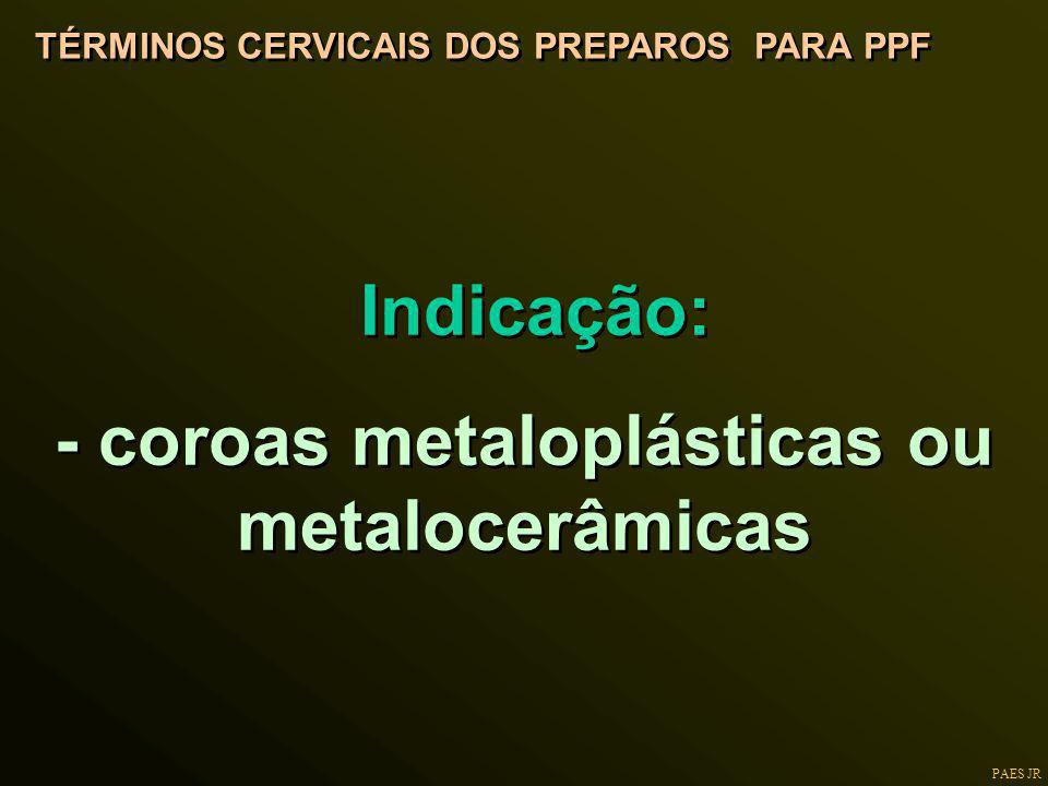 - coroas metaloplásticas ou metalocerâmicas