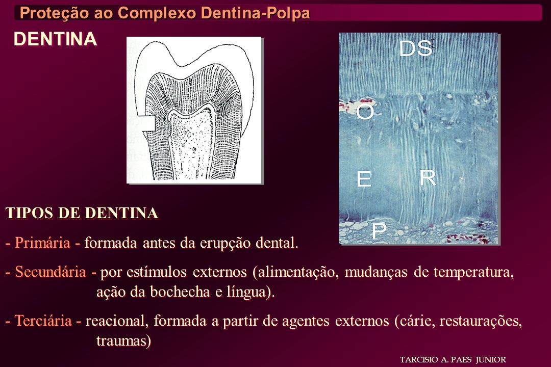 DENTINA Proteção ao Complexo Dentina-Polpa TIPOS DE DENTINA