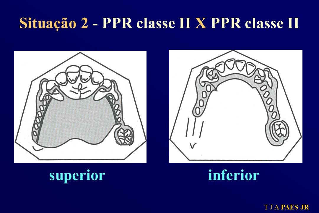 Situação 2 - PPR classe II X PPR classe II
