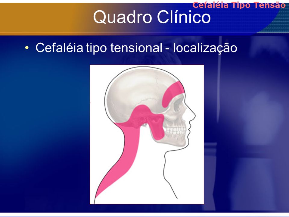 Quadro Clínico Cefaléia tipo tensional - localização
