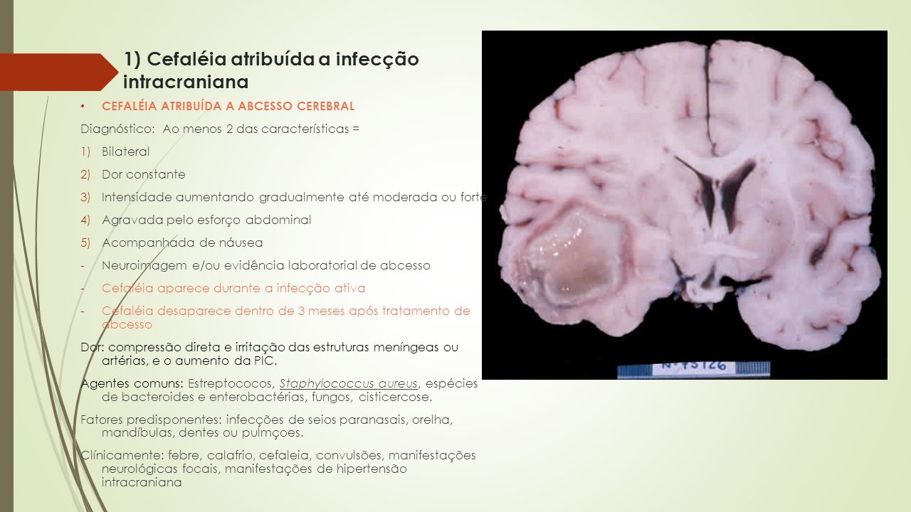 1) Cefaléia atribuída a infecção intracraniana
