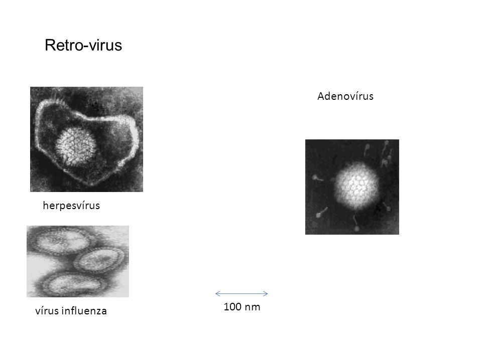 Retro-virus Adenovírus herpesvírus 100 nm vírus influenza