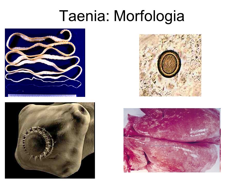 Taenia: Morfologia