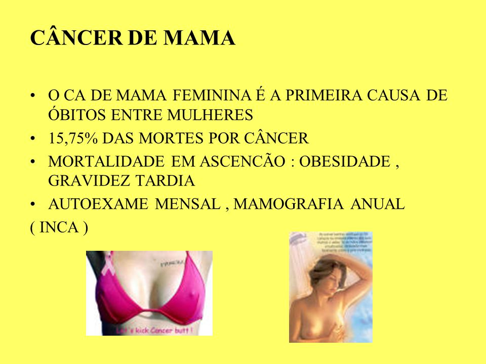 CÂNCER DE MAMA O CA DE MAMA FEMININA É A PRIMEIRA CAUSA DE ÓBITOS ENTRE MULHERES. 15,75% DAS MORTES POR CÂNCER.