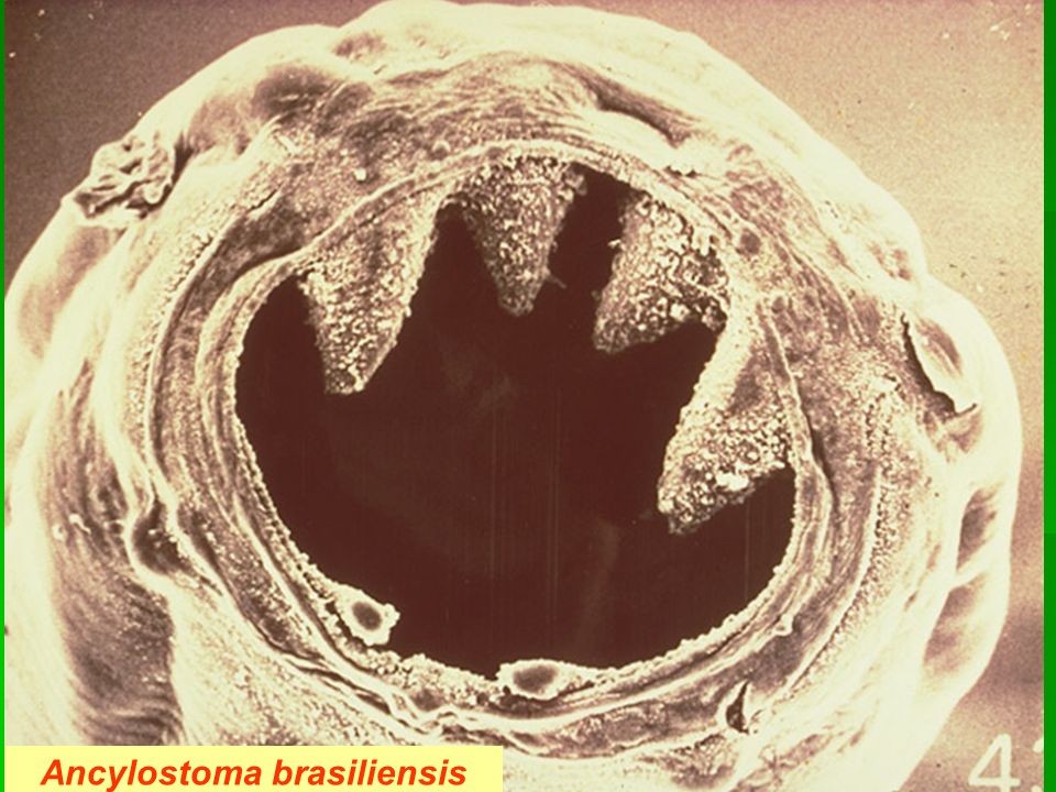 Ancylostoma brasiliensis