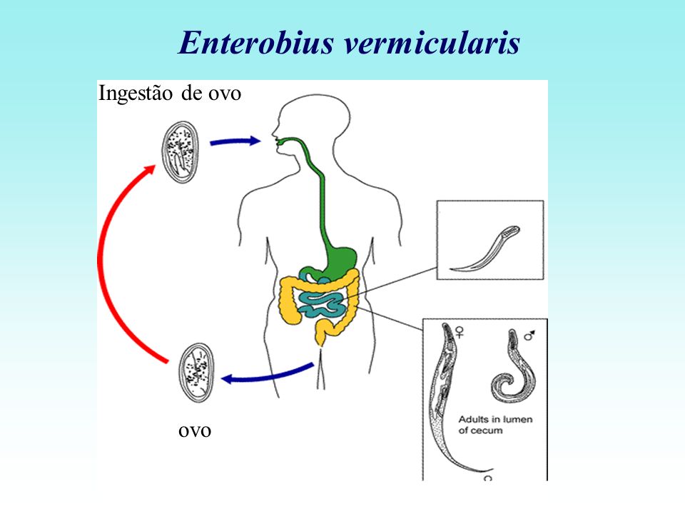 enterobius vermicularis agente etiologico)