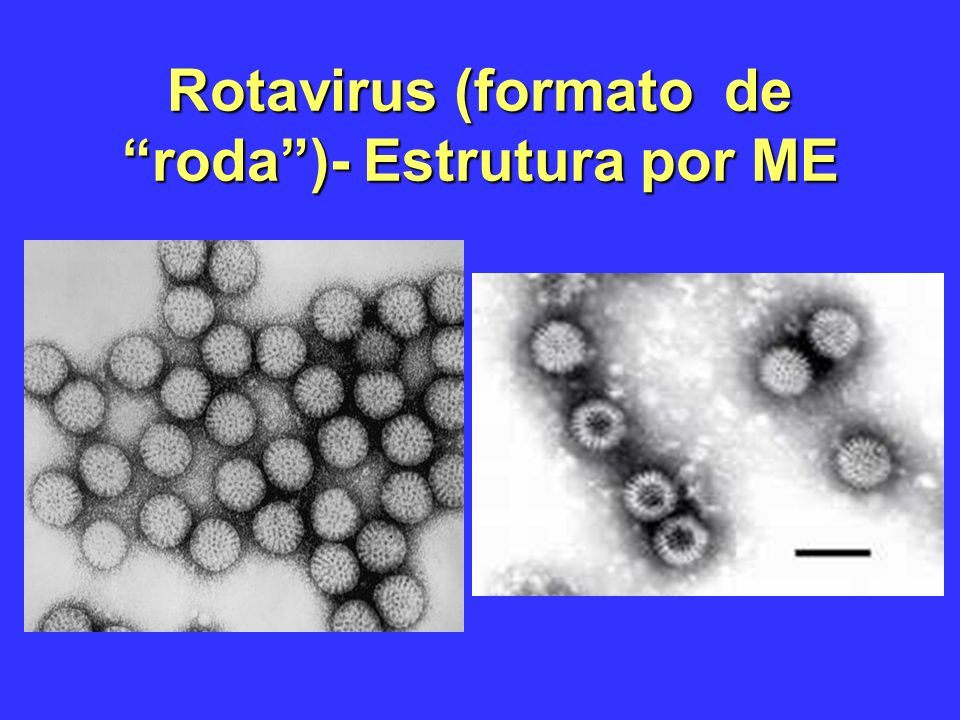 Rotavirus (formato de roda )- Estrutura por ME