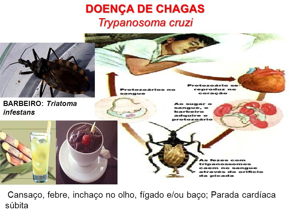 DOENÇA DE CHAGAS Trypanosoma cruzi