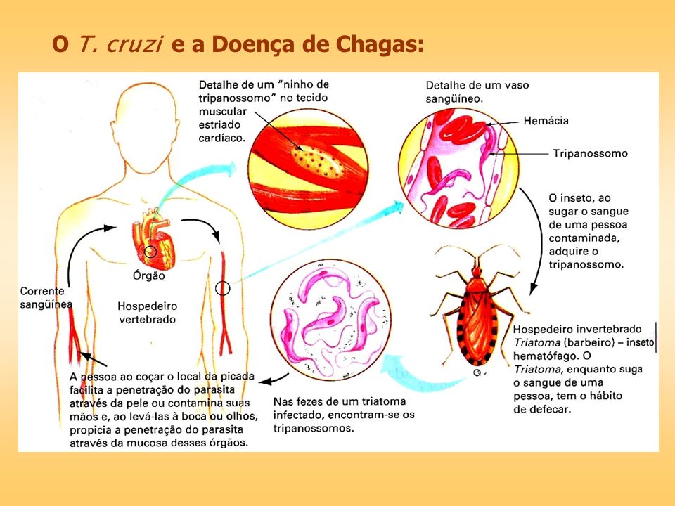 O T. cruzi e a Doença de Chagas: