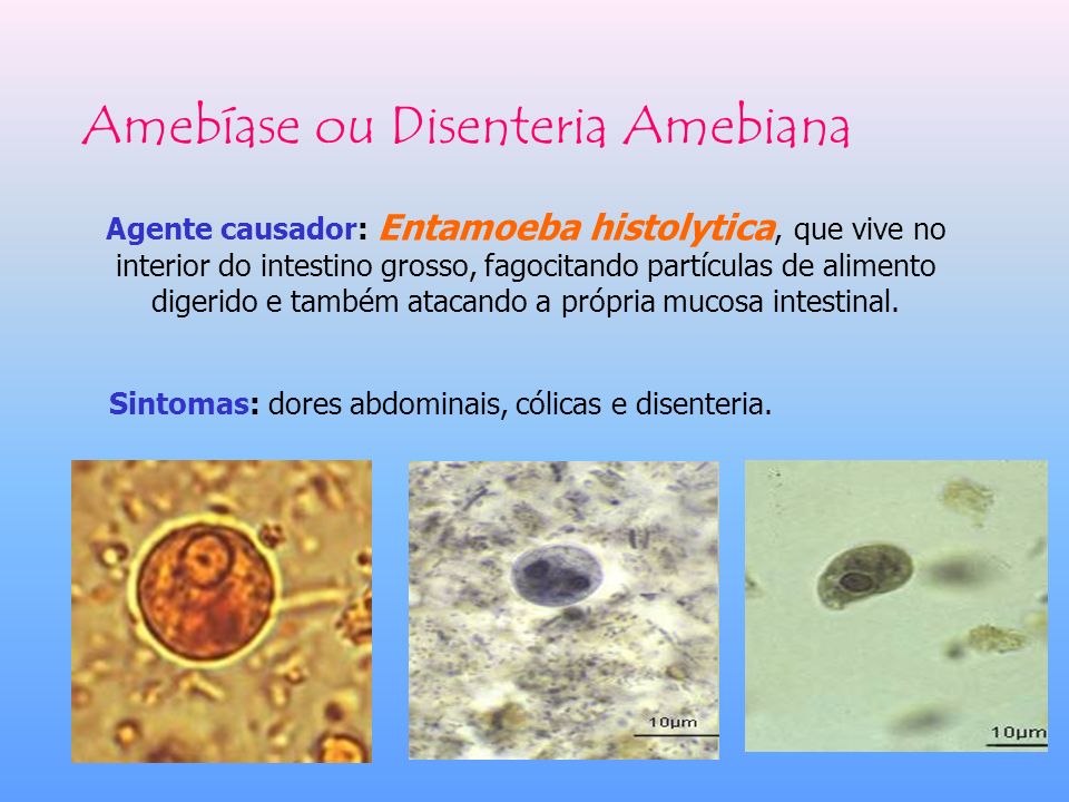 Amebíase ou Disenteria Amebiana