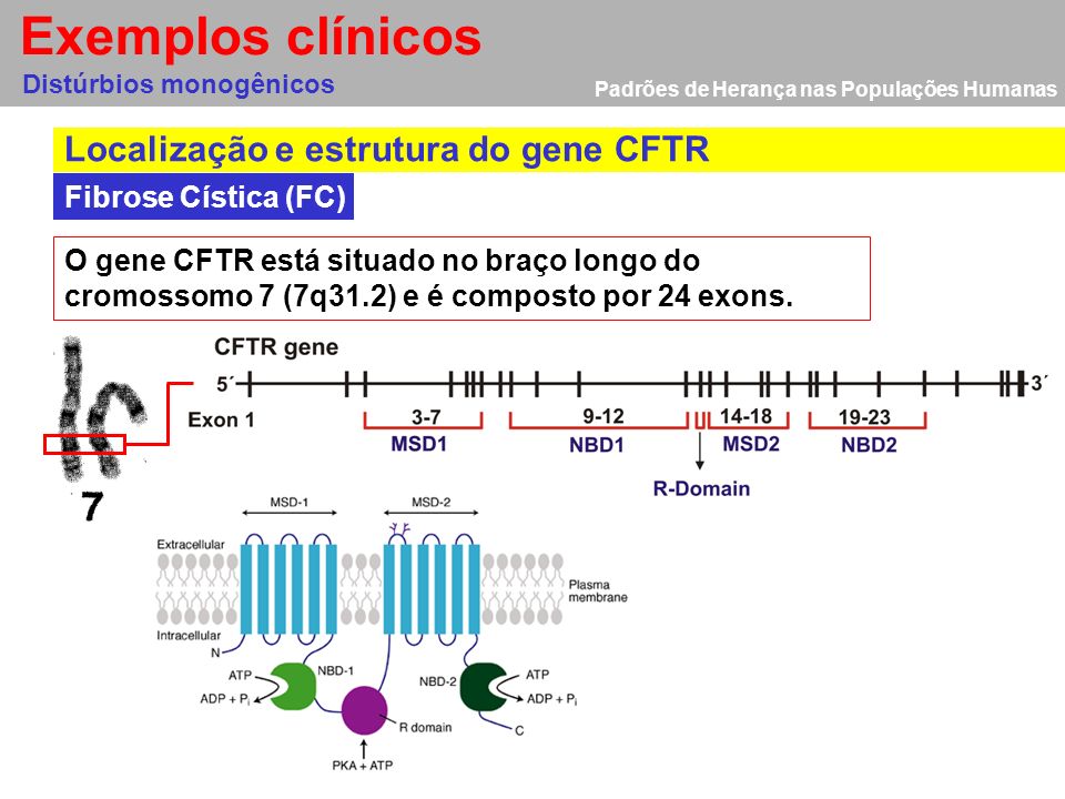 Exemplos clínicos Localização e estrutura do gene CFTR