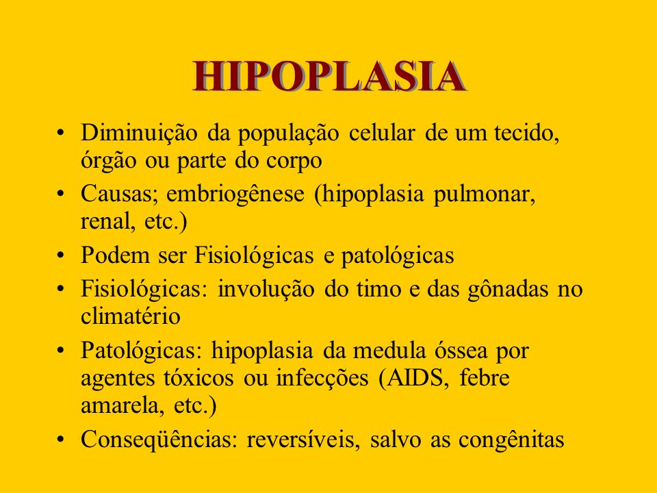 HIPOPLASIA Diminuição da população celular de um tecido, órgão ou parte do corpo. Causas; embriogênese (hipoplasia pulmonar, renal, etc.)